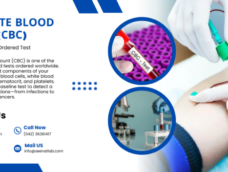 Complete Blood Count CBC Why Its the Most Ordered Test - Authentic Zeenat Laboratory | Dr. Zeenat Hussain legacy