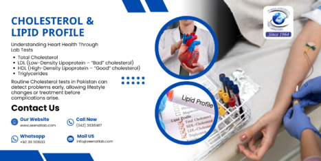Cholesterol and Lipid Profile - Authentic Zeenat Laboratory | Dr. Zeenat Hussain legacy