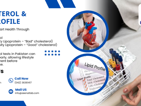 Cholesterol and Lipid Profile - Authentic Zeenat Laboratory | Dr. Zeenat Hussain legacy