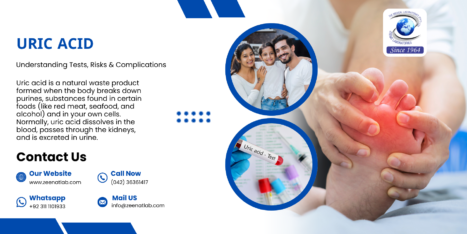 Uric Acid Understanding Tests Risks Complications - Authentic Zeenat Laboratory | Dr. Zeenat Hussain legacy