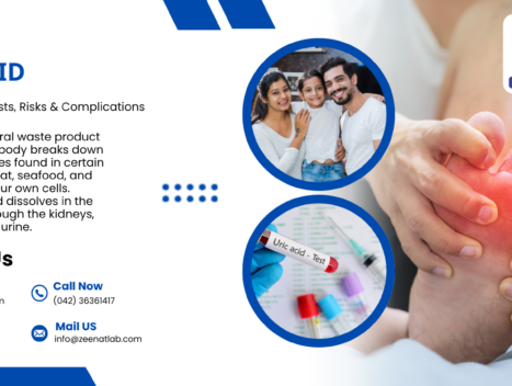 Uric Acid Understanding Tests Risks Complications - Authentic Zeenat Laboratory | Dr. Zeenat Hussain legacy
